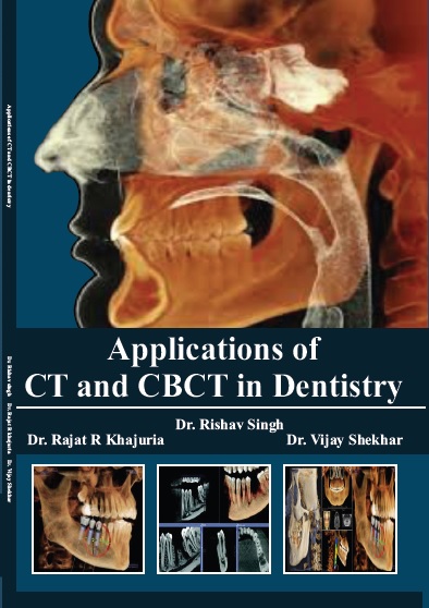 Applications of CT and CBCT in Dentistry