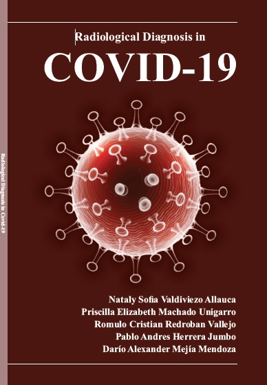 RADIOLOGICAL DIAGNOSIS IN COVID-19